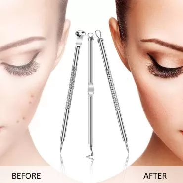 [Dual Ended] 7PCS Blackhead Remover, Comedone Pimp...