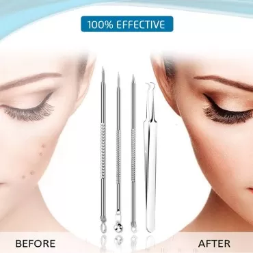 [Upgraded] 8PCS Blackhead Remover, Pimple Tool Kit...