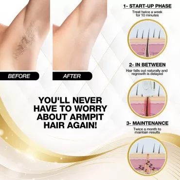 IPL Laser Hair Removal Device, Luxury IPL hair removal, Pain-Free Hair Remover for Women, Laser Hair Removal Device, IPL Laser Permanent Hair Removal for Women (White)