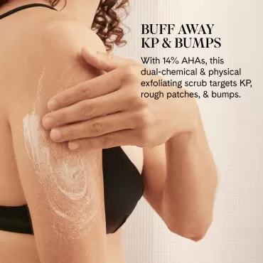 Fur KP Body Scrub - Powerful 14% AHA Body Scrub for Keratosis Pilaris or Rough Patches to Smooth and Clear Skin using Lactic Acid and Physical Exfoliants While Moisturizing the Skin - 6 oz