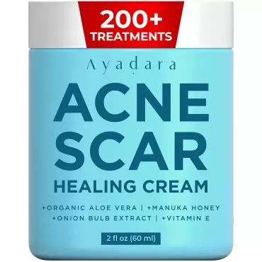 Ayadara Acne Scar Healing Cream, 2 fl oz, Acne Sca...