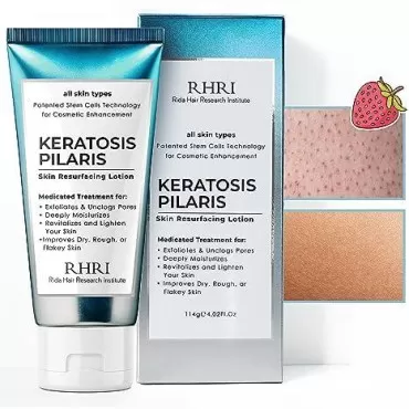 Keratosis Pilaris Lotion with Glycolic Acid, AHA & BHA Exfoliating | Strawberry Legs, KP & Ingrown Hair Treatment | Bumpy Skin Body Lotion | Moisturizing Cream for Redness, Dry, Rough & Flakey Skin