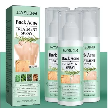 3 Pack Back Acne Treatment, Back Acne Spray, 2% Sa...